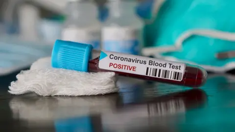 Getty Images A coronavirus blood test