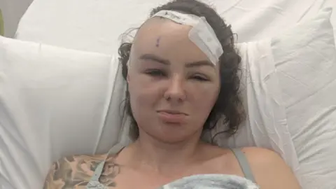 Christel Calow Christel after the operation