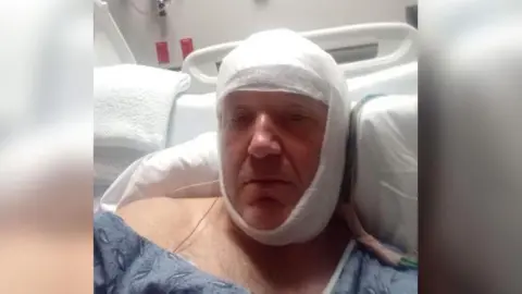 SUPPLIED Man lying in a hospital bed with bandage around his head 