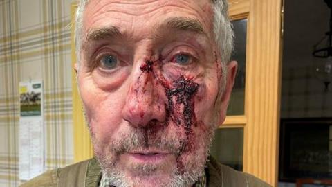 Man who was attacked with serious facial injuries