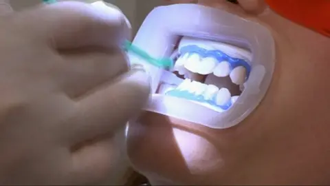 Teeth whitening