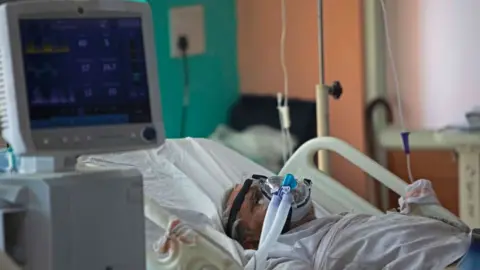 XAVIER GALIANA In this photograph taken on July 15, 2020 a COVID-19 coronavirus patient lies on a bed at the Intensive Care Unit of the Sharda Hospital, in Greater Noida