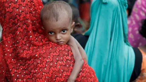 Reuters A malnourished Rohingya refugee in Cox's Bazar, Bangladesh. Photo: 24 September 2017