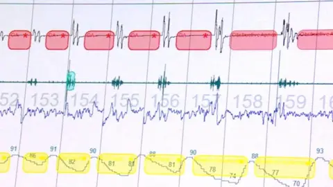 BBC News Computer screen with sleep test results on.