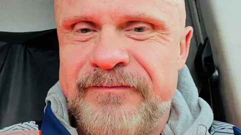 Man with greying beard and hooded top (with hood down) looking at camera