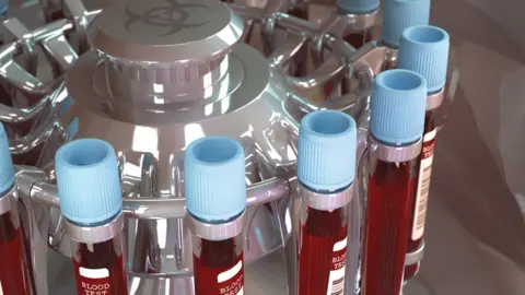 Getty Images Blood tests in laboratory