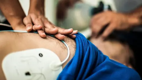 Getty Images Defibrillator is used on a man