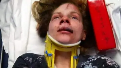 Louise Gilmore Louise Gilmore in hospital