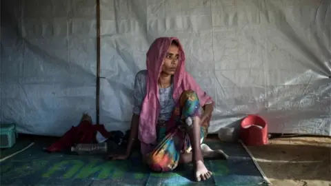 AFP A Rohingya Muslim refugee Nosuba Khatun (40) shows the bullet wound inflicted while fleeing from an attack by the Myanmar military at her shelter in the Kutupalong refugee camp in Cox's Bazar on December 4 2017