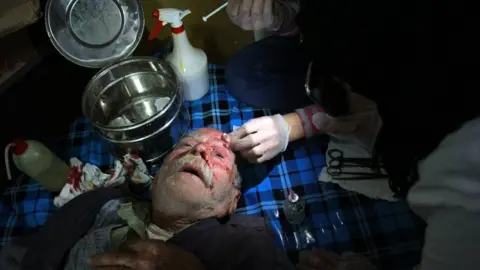 AFP A wounded Syrian man receives first aid treatment at a makeshift hospital in Douma, in the besieged rebel-held Eastern Ghouta, on 20 February 2018