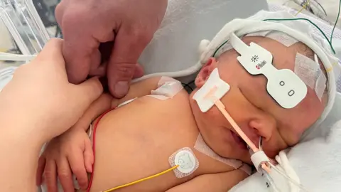 A newborn child in a hospital cot with medical equipment on her head and chest.