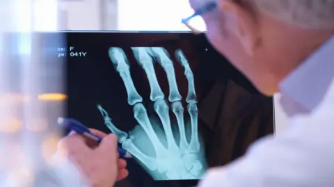 Doctor looking at an X-ray of someone's hand