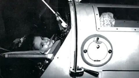 Cindy McVey Handout Black and white photo of of Martha Lillard in the iron lung as a child