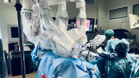 Surgeons in an operating theatre at Southmead hospital carry out a procedure using robotic arms. The image shows a patient covered in blue surgical sheets. Two medical staff stand beside the patient and robotic arms covered in plastic sheeting are above the patient. 
