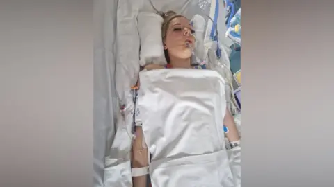 Supplied A teenager laid on a hospital bed, with a tube in her mouth and in her arms. She has her eyes closed and has a white sheet on her.