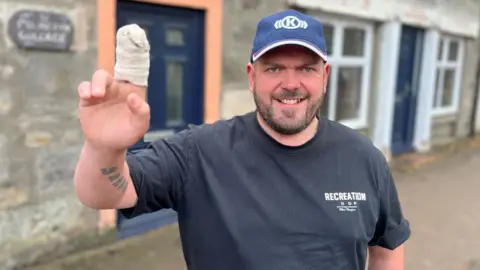 Struan Gunn is in a street. He has designer facial stubble and is wearing a blue cap and a dark blue T-shirt. He is smiling as he holds up a hand with two bandaged fingers.