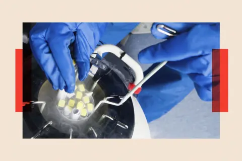 Universal Images Group via Getty Images Doctors hands removing embryo samples from cryogenic storage
