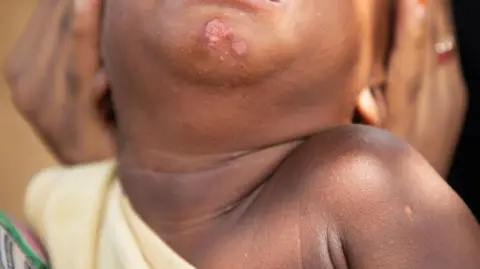 Fatima Holds his head to show the pain of the toddleri's heads on the chin caused by skin radiant products