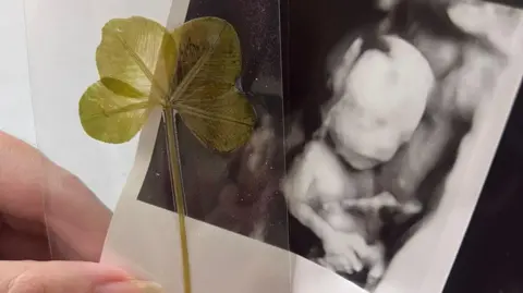 NHSBT A hand holds an ultrasound scan showing a baby before birth next to a pressed four‑leaf clover encased in a clear plastic sleeve.
