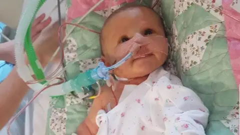 A small baby lies in a hospital cot with a white and green medical tube inserted into her nose
