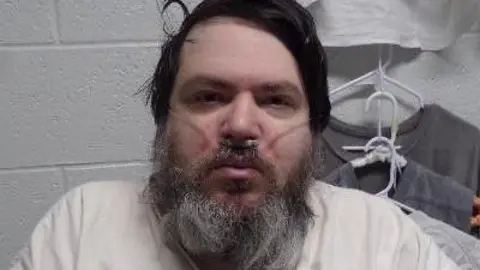 A man with black hair and a long black/grey beard has a breathing tube in his nose