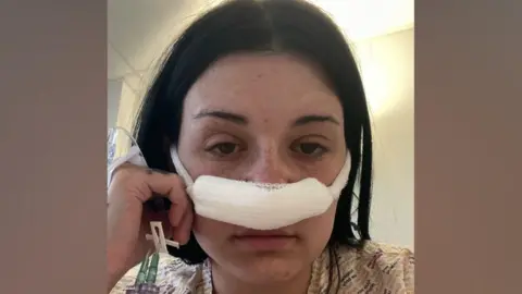 Libby Woolaston The image shows a woman with dark brown hair wearing a hospital gown, seated in a clinical setting, with a nasal dressing taped across the bridge of the nose and an intravenous line visible in one hand, suggesting recovery after a medical procedure.