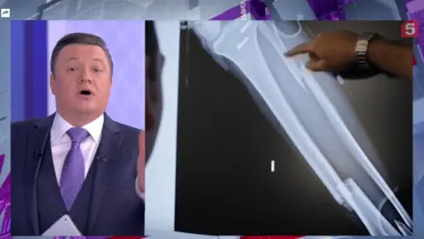 Channel Five Russian TV presenter pictured talking on the left and an image of a person pointing at a scan of a broken limb on the right