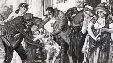 Getty Images English physician Edward Jenner's first smallpox vaccination, performed on James Phipps in 1796. From a painting by GG Melingue