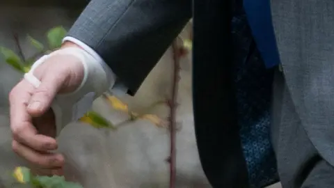 PA Ben Stokes's bandaged right hand