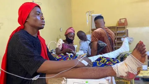 BBC/Olumide Owaduge An injured woman in hospital with leg raised