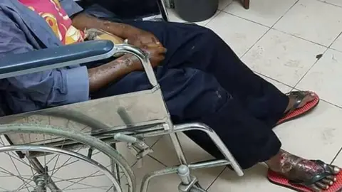 Migrant Care Adelina was found with untreated wounds on her arms and legs