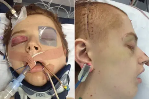 Joseph Shovlin Joseph in hospital