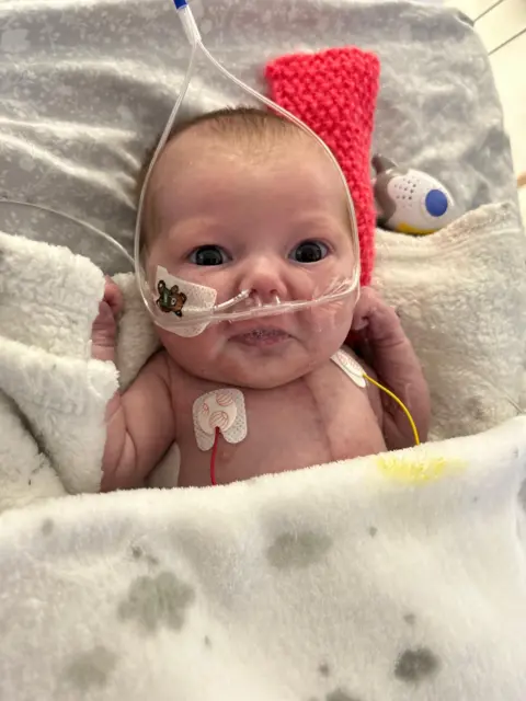 SUPPLIED Fleur with tubes after the operation