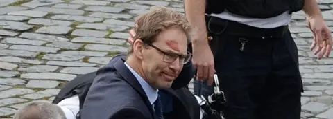 PA Tobias Ellwood with blood on his face after the attack