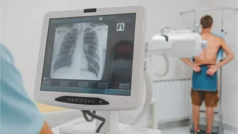 Getty Images file picture of chest x-ray