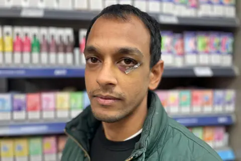 Amit Pantambar faced the camera, wearing a green quilt made of jacket, in front of VEPS store display. He has a plaster under his left eye where he was punched. 