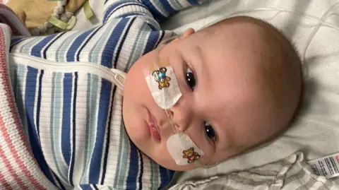 Contributed Jonah is pictured lying down in a bed. He has his eyes open and is looking away from the camera. He has a tube around his face that connects to his nose while a blanket rests over his lower half and he is wearing a stripey blue and white baby grow. 