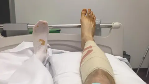 Andy Tucker's legs in hospital bed