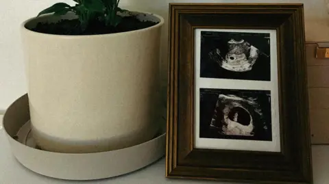 Alaw Llyfni A photo frame showing a scan of Alaw's baby. Next to the photo frame is a plant pot with a green plant inside. 