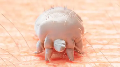 An illustration of a microscopic image of Sarcoptes scabiei, a tiny mite that causes scabies. The mite has several legs, a fat, round body and small hairs on its back. It is standing on what appears to be skin with several fine hairs coming out of it. 
