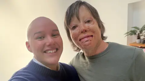 Laura Mathias Laura Mathias, pictured with a friend who has a facial disfigurement.