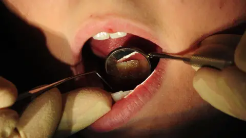 An open mouth with a dental mirror being used, as a dentist checks or scrapes the teeth of a patient. The dentist has gloved hands.