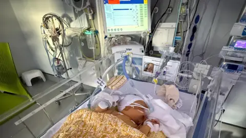 Jade A hospital neonatal intensive care unit with Arwell lying in an incubator bed covered by a yellow knitted blanket. The baby is surrounded by medical equipment, including monitors, tubes and wires. A large screen above the bed displays vital signs and patient information.