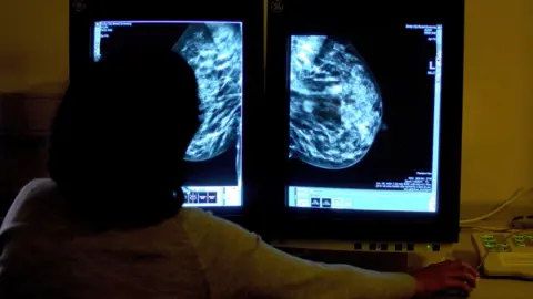 PA Media An archive image of a mammogram. The doctor turns his back to the camera and looks at the screen.