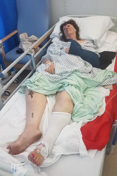 Dave Mathias A woman injured and lying on a hospital bed 