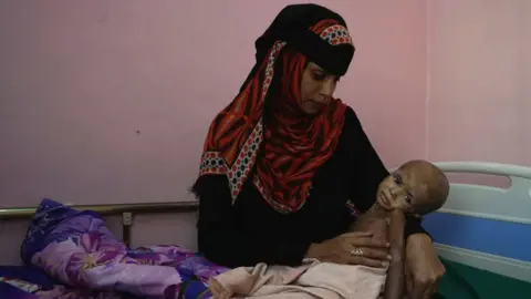 Getty Images A mother is pictured in a clinic near Hudaydah with her child who is malnourished.