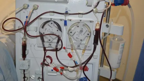 A dialysis machine