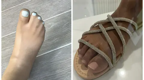 Louise Munckton Side by side images of a prosthetic foot with a separate big toe and four connected smaller toes and a prosthetic foot with five separate toes in a sandal