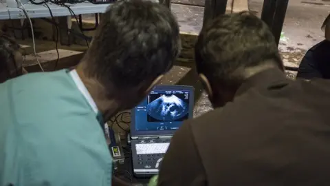 Longleat Rhino ultrasound