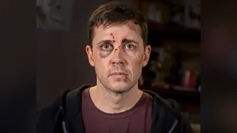 ITV/Coronation Street Gareth Pierce as Todd Grimshaw in the purple-themed stylistic episode - he has a black eye and wears a purple t-shirt.